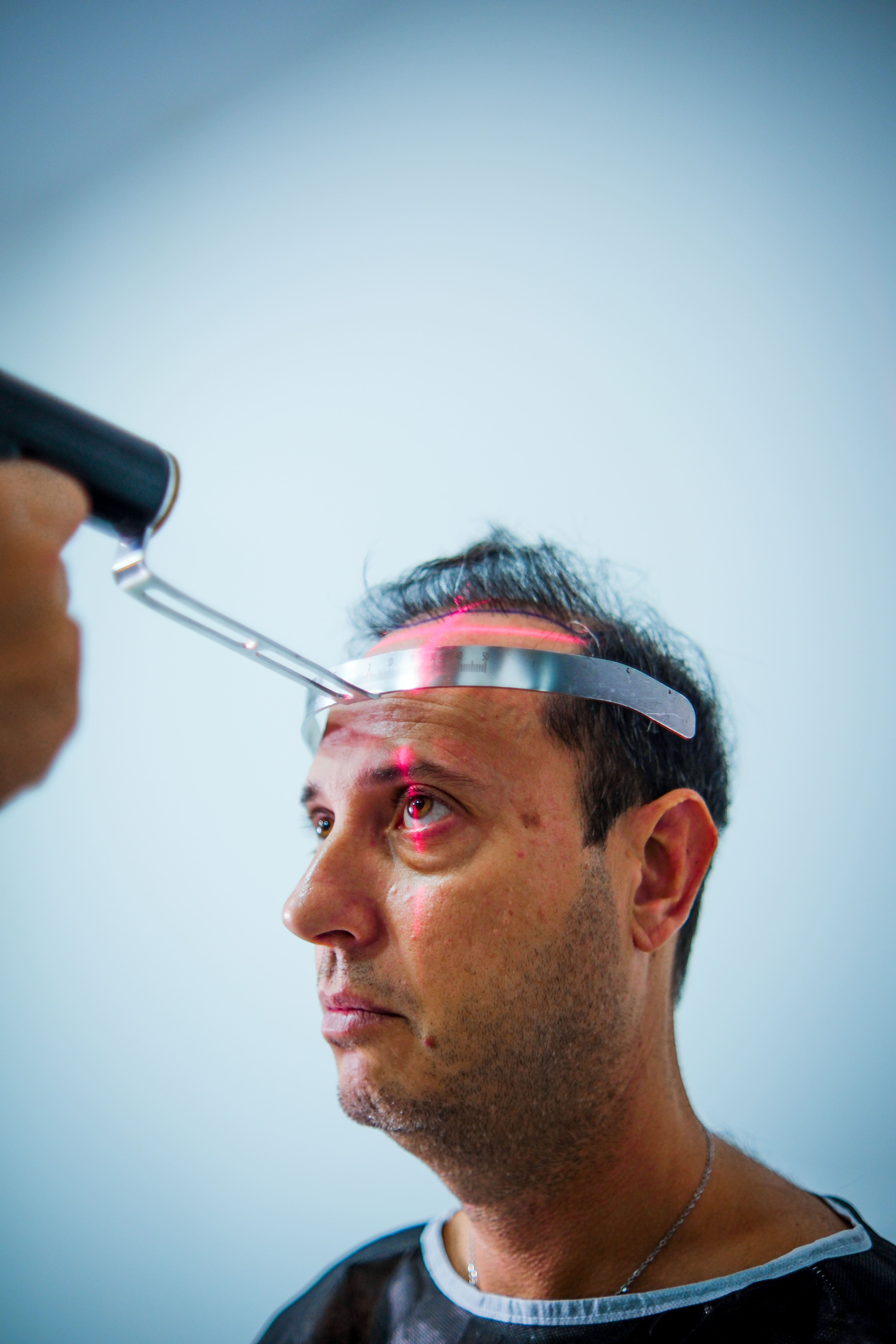 Shave-Free Hair Transplant Innovation